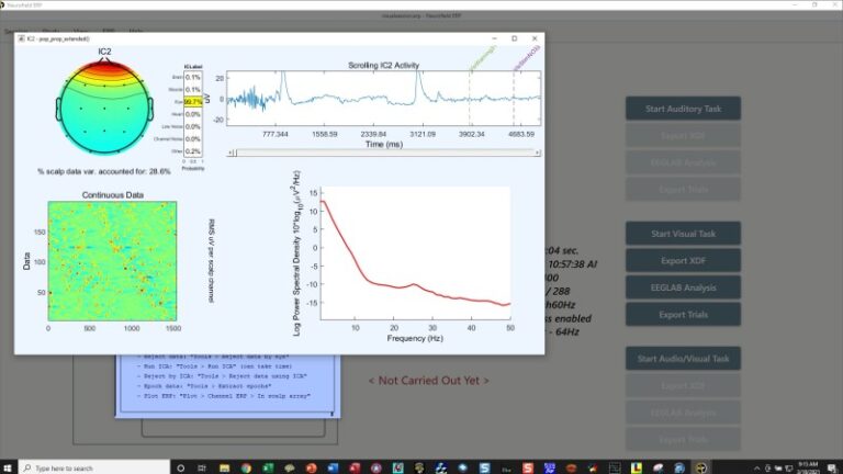 erpicacomponent1_gallery