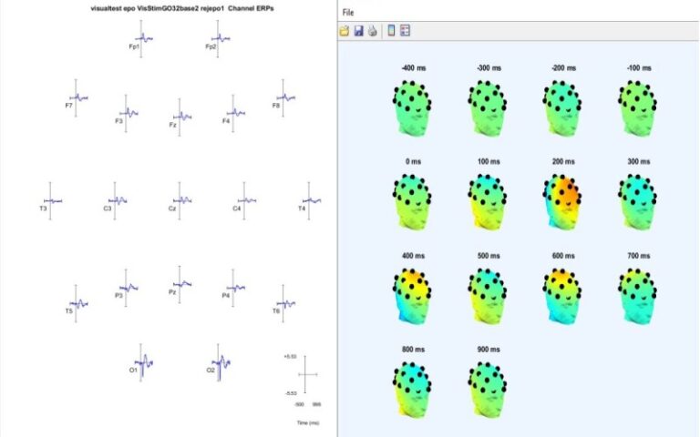 erpicaspec999_gallery